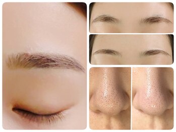 トータルビューティ ノイド(Noid)/いちご鼻撃退+美眉毛WAX脱毛