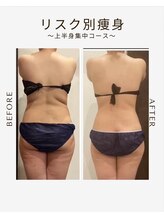 ビーシェイプ 君津(B-Shape)/【痩身】ビフォーアフター
