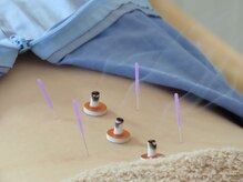 コンはりきゅう院 整骨院(KONはりきゅう院 整骨院)の雰囲気(【鍼灸】めまい、耳鳴り、眼精疲労、食欲不振、生理悩み、妊活に)