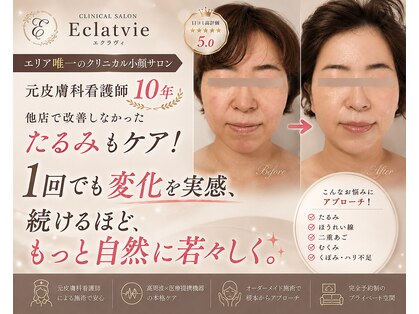 エクラヴィ(Eclatvie)の写真