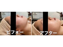 ファイン 水戸店(Fine)/魔法の小顔