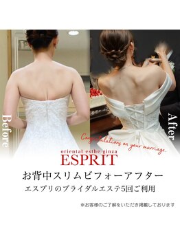 エスプリ 新宿店/ブライダルエステ新宿・痩身新宿
