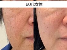 サクラ 本厚木駅前店(SAKURA)/本厚木シミケア/伊勢店シミケア