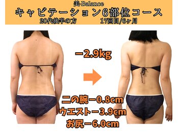 ビーバランス 本町店(美-Balance)/20代後半　月6部位コース
