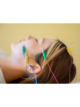 鍼灸施術を受けたい