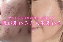 ユウビジン(YOU美人)