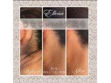 エレーナ 横浜(Ellena)の雰囲気（VIO脱毛に続き、うなじ脱毛も大人気メニューです♪）