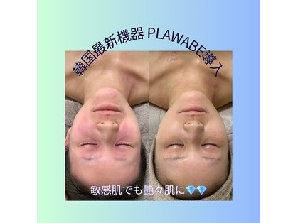 ニコ(25)の写真