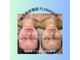 ニコ(25)の写真