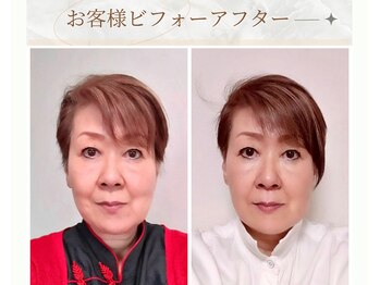 プランドール/リフトアップで若見え☆