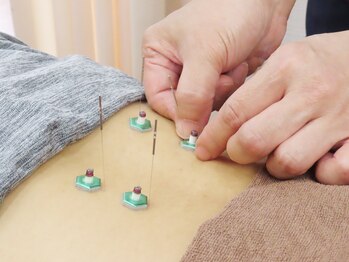 みのわ接骨院の写真/肩こりや辛い疲れを改善する鍼施術からほうれい線や肌質を改善する美容鍼まで幅広く対応！