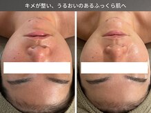 リラケア 三郷店/うるおいのあるふっくら肌へ
