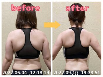 美容整体院元 光の森店/背中のたるみ改善ハミ肉改善!