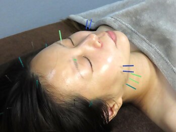 はりめぐり/美容鍼