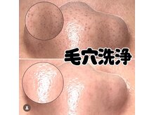 ディエール(Diailes)/毛穴洗浄