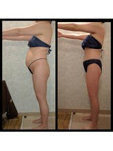 ビューティースリム タニダ/