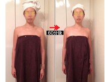 美座ノ女 梅田 淀屋橋本店/施術前後(正面)