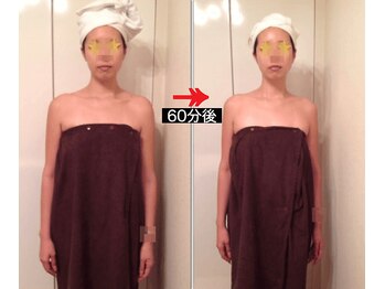 美座ノ女 梅田 淀屋橋本店/施術前後(正面)