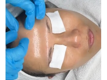 スア(SUA)/3D水光ピーリング