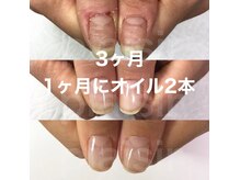 マリーシーオー(MARY-CO.)の雰囲気（自爪育成/3ヶ月経過(ホームケアでオイル2本使用)）