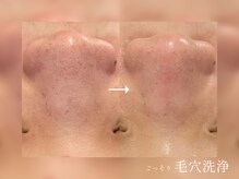 オヤム(oyam)の雰囲気（毛穴悩みに人気のメニューを多数ご用意♪）