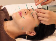 東京中医学研究所 胡同の雰囲気(美容鍼が当店一押しのオススメのメニューです!)