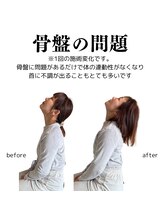 整体院チルアンドママ(CHILL&mama)/骨盤からくる不調もあります