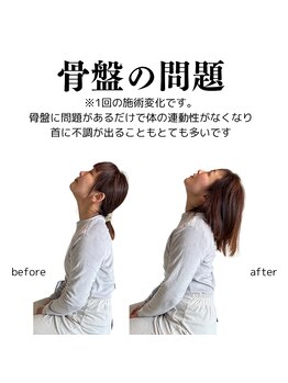 整体院チルアンドママ(CHILL&mama)/骨盤からくる不調もあります