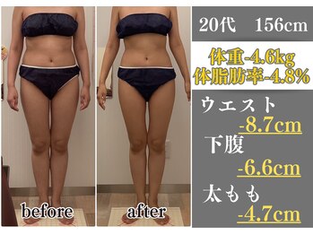 ラ コンシェル 町田店/Before After【町田店】