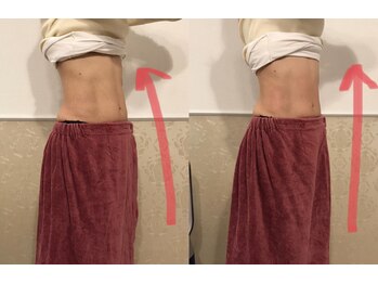 アンベリール 広尾/前後写真☆姿勢改善♪