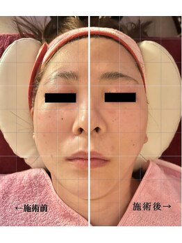 ルミナス(Luminous)/美肌＆小顔