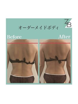 ザラハビューティー(ZARAHA Beauty)/オーダーメイドボディ