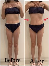 スペチアーレ 夙川/湘南や品川でも大人気の脂肪冷却