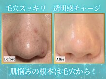 リメイククリニカルビューティー(Remake clinical beauty)の雰囲気（肌悩み原因の全ては毛穴から、何をするにもまずはコレ）