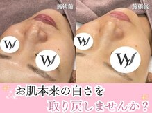 翌日から化粧ノリ◎月イチの草むしりで韓国艶美肌に！