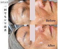 ヴィタベラ(Vita Bella)/ラミネーションピール