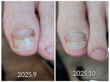 爪切り屋 足楽/【自爪育成】伸びない爪をケア