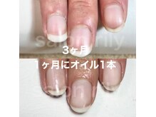 マリーシーオー(MARY-CO.)の雰囲気（自爪育成/3ヶ月経過(ホームケアでオイル1本使用)）