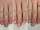 ニコッテ 本厚木(nicotte.)の写真/本厚木★自爪ケア/巻き爪解消/深爪/爪の悩みも解消してくれる、旬ネイルが叶うサロン