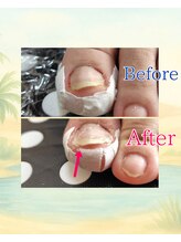 リフロー 湖南店(re-flow)/立ち仕事の多い美容師さん