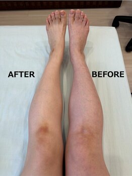 スターズウィズ カイロプラクティック オプ(StarS with)/足の冷えケア★