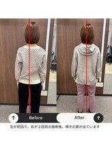 ルピナス整体院/姿勢ビフォーアフター