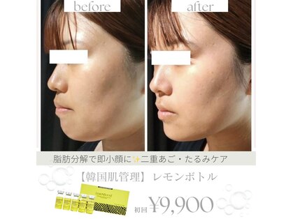 アエリ(AERI)の写真