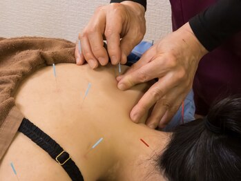 いなほ はりきゅう整骨院 東新宿/鍼灸(吸い玉併用)コース