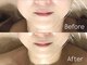 アドネ(Adone)の写真
