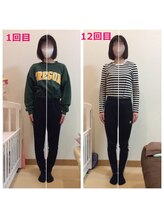 こおりやま整体院/O脚矯正にも大きな変化