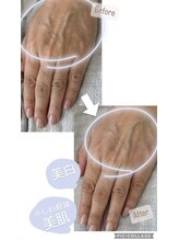 シーオングル(Siii ongle)/フットをしながらハンドマスク