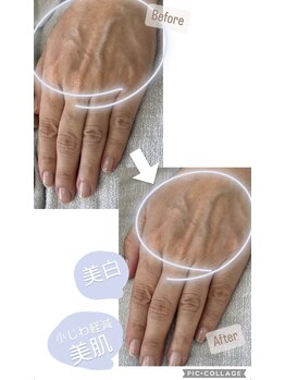 シーオングル(Siii ongle)/フットをしながらハンドマスク