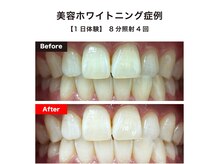 ハイティース 高田馬場店(Hi Teeth!)の雰囲気（気軽にトライできる体験クーポンご用意あります◎）