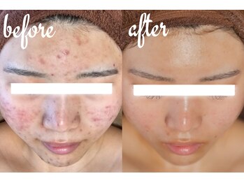 ユウビジン(YOU美人)